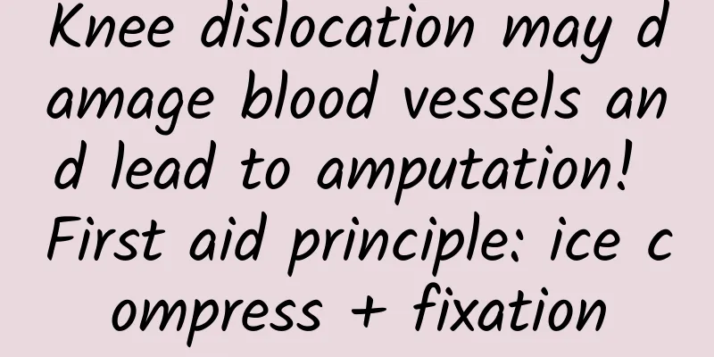 Knee dislocation may damage blood vessels and lead to amputation! First aid principle: ice compress + fixation