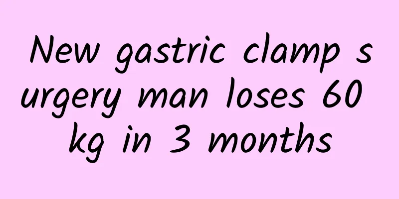 New gastric clamp surgery man loses 60 kg in 3 months