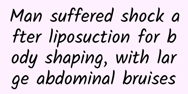 Man suffered shock after liposuction for body shaping, with large abdominal bruises