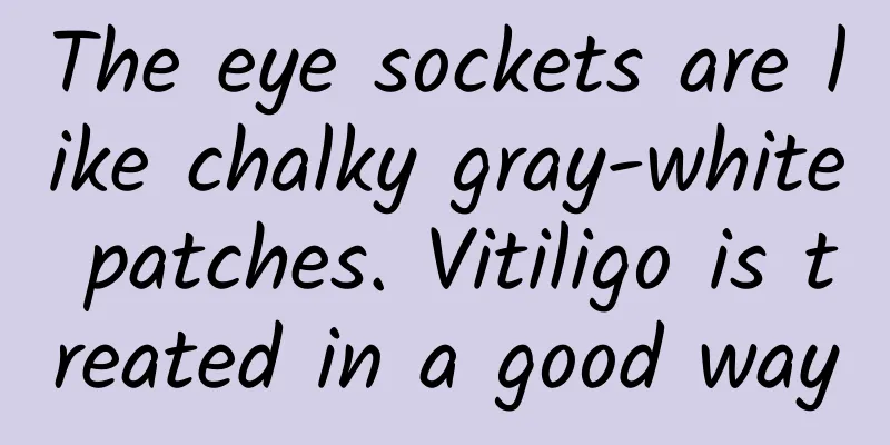 The eye sockets are like chalky gray-white patches. Vitiligo is treated in a good way