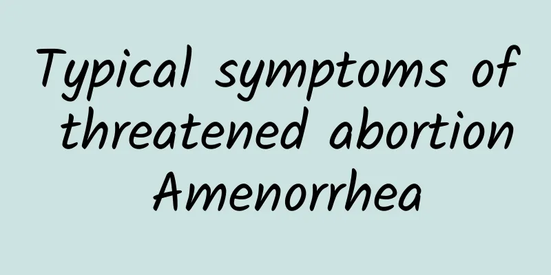 Typical symptoms of threatened abortion Amenorrhea