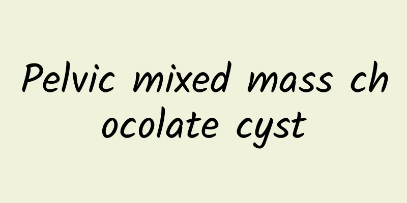 Pelvic mixed mass chocolate cyst