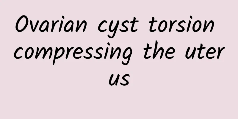 Ovarian cyst torsion compressing the uterus