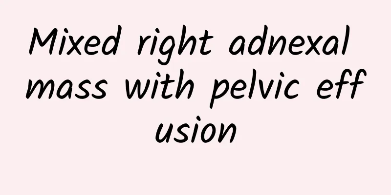 Mixed right adnexal mass with pelvic effusion