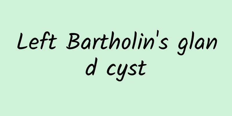 Left Bartholin's gland cyst