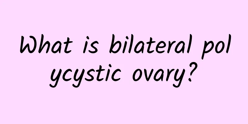 What is bilateral polycystic ovary?