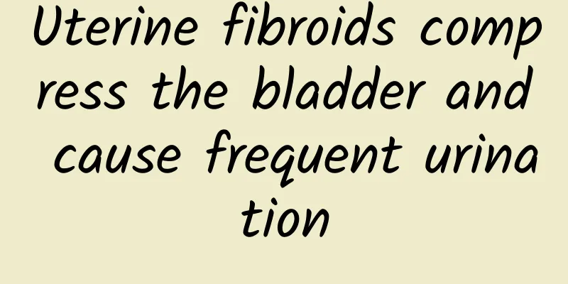 Uterine fibroids compress the bladder and cause frequent urination