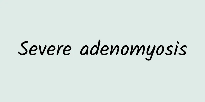 Severe adenomyosis