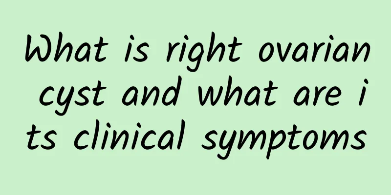 What is right ovarian cyst and what are its clinical symptoms
