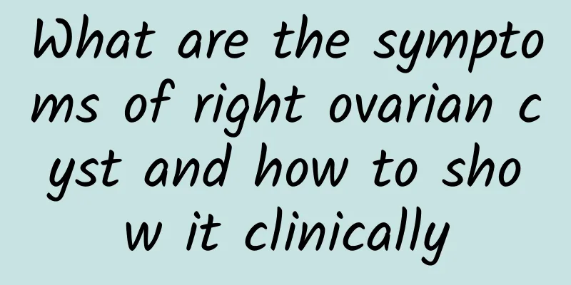 What are the symptoms of right ovarian cyst and how to show it clinically