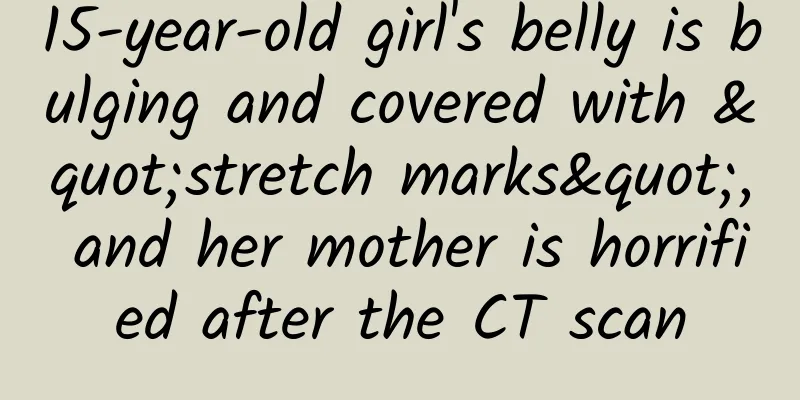 15-year-old girl's belly is bulging and covered with "stretch marks", and her mother is horrified after the CT scan