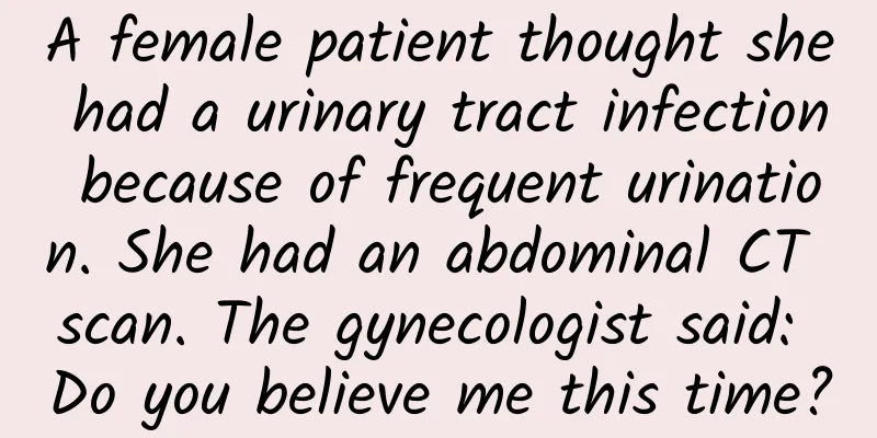 A female patient thought she had a urinary tract infection because of frequent urination. She had an abdominal CT scan. The gynecologist said: Do you believe me this time?