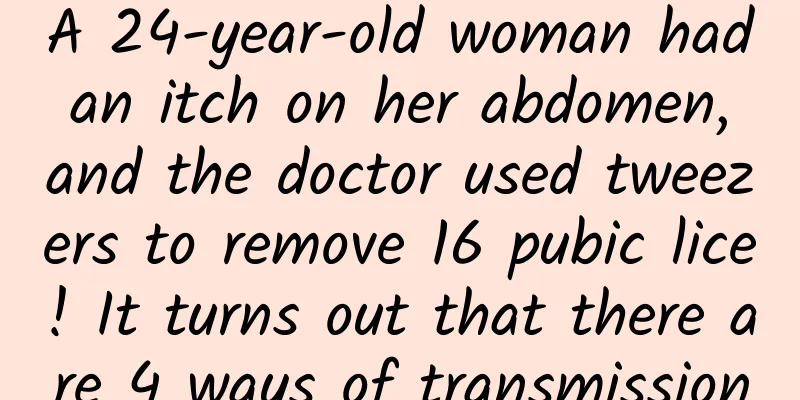 A 24-year-old woman had an itch on her abdomen, and the doctor used tweezers to remove 16 pubic lice! It turns out that there are 4 ways of transmission