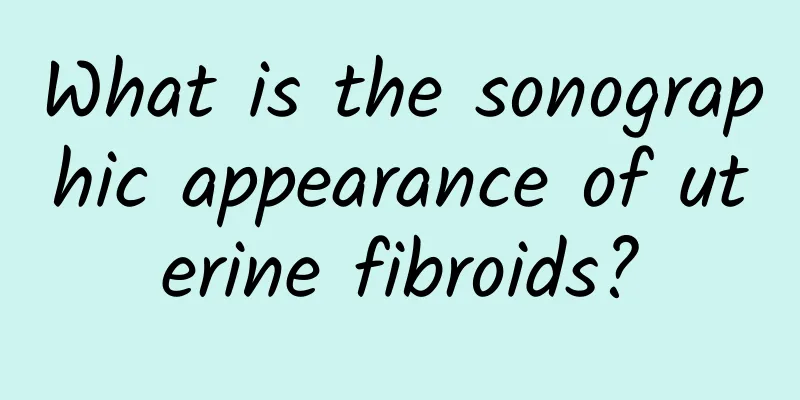 What is the sonographic appearance of uterine fibroids?
