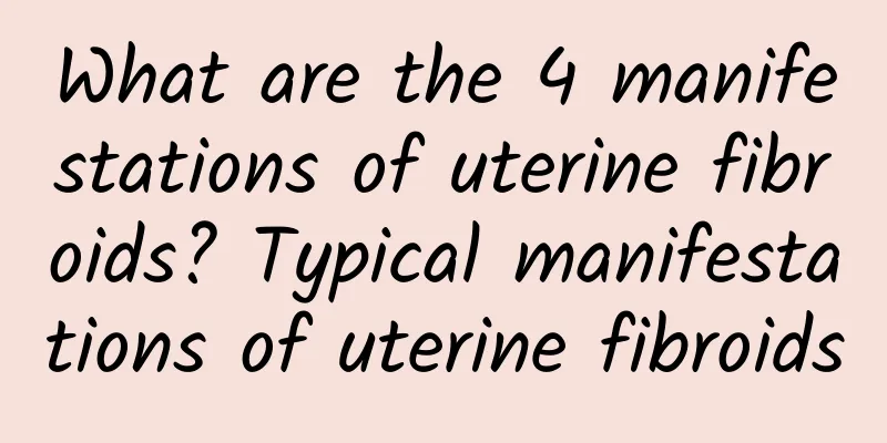 What are the 4 manifestations of uterine fibroids? Typical manifestations of uterine fibroids