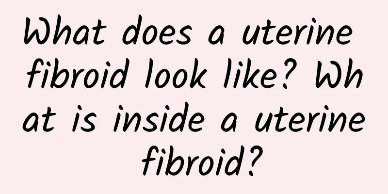 What does a uterine fibroid look like? What is inside a uterine fibroid?