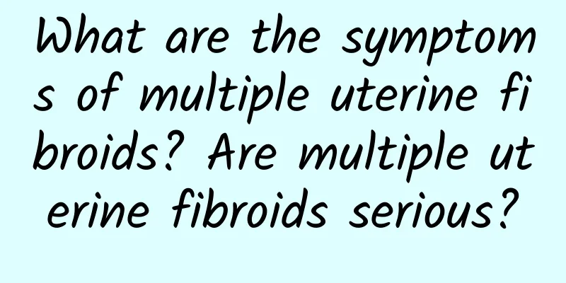 What are the symptoms of multiple uterine fibroids? Are multiple uterine fibroids serious?