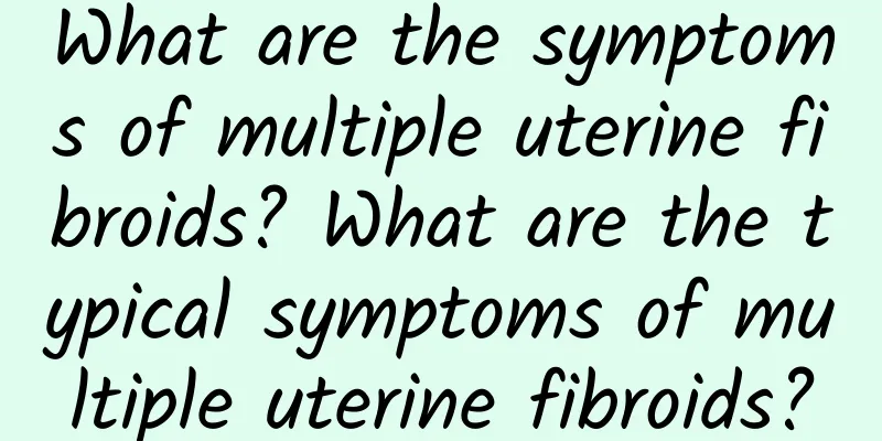 What are the symptoms of multiple uterine fibroids? What are the typical symptoms of multiple uterine fibroids?