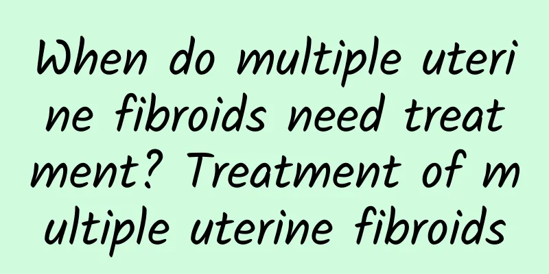 When do multiple uterine fibroids need treatment? Treatment of multiple uterine fibroids