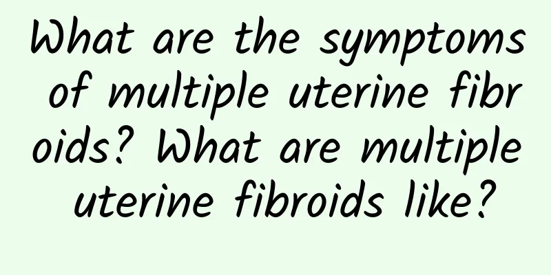 What are the symptoms of multiple uterine fibroids? What are multiple uterine fibroids like?