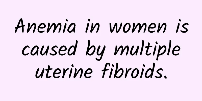 Anemia in women is caused by multiple uterine fibroids.