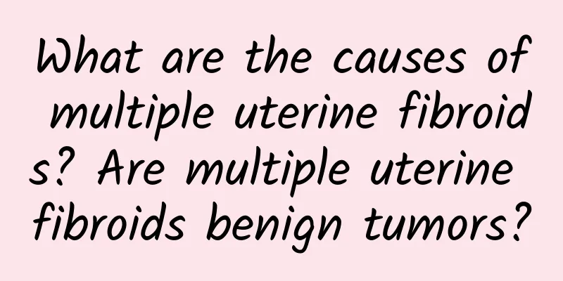 What are the causes of multiple uterine fibroids? Are multiple uterine fibroids benign tumors?