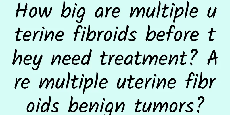 How big are multiple uterine fibroids before they need treatment? Are multiple uterine fibroids benign tumors?