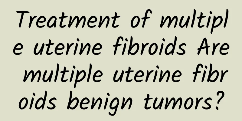 Treatment of multiple uterine fibroids Are multiple uterine fibroids benign tumors?