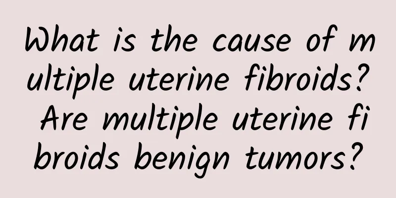 What is the cause of multiple uterine fibroids? Are multiple uterine fibroids benign tumors?