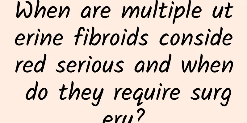 When are multiple uterine fibroids considered serious and when do they require surgery?