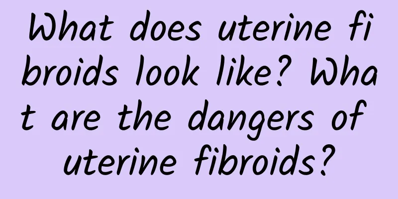 What does uterine fibroids look like? What are the dangers of uterine fibroids?