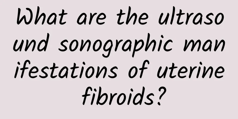 What are the ultrasound sonographic manifestations of uterine fibroids?