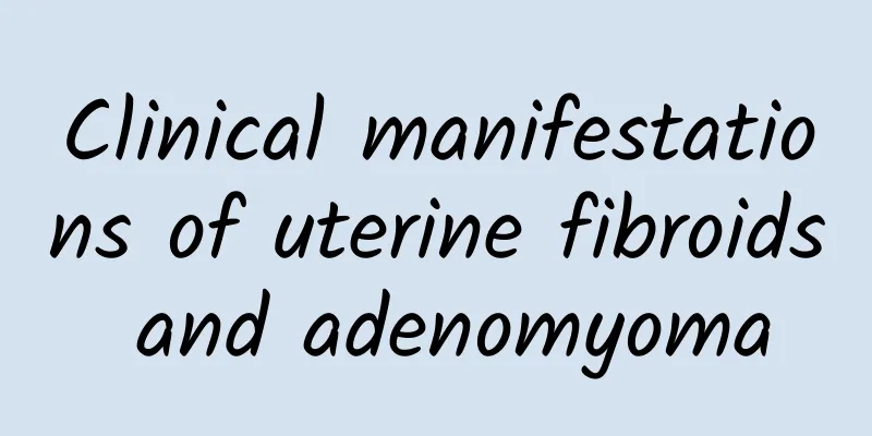 Clinical manifestations of uterine fibroids and adenomyoma