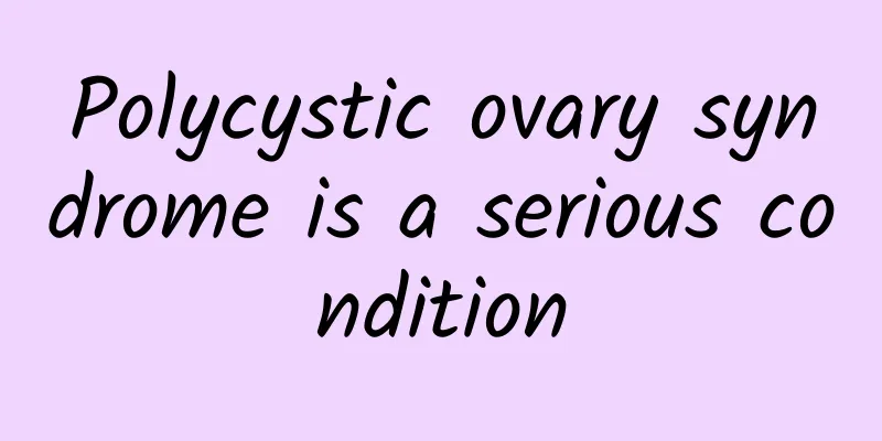Polycystic ovary syndrome is a serious condition