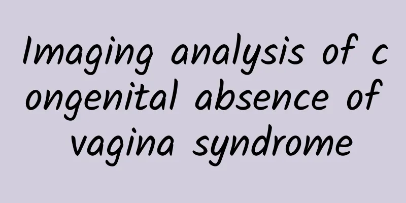 Imaging analysis of congenital absence of vagina syndrome