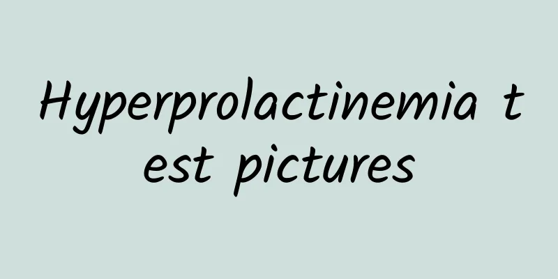 Hyperprolactinemia test pictures