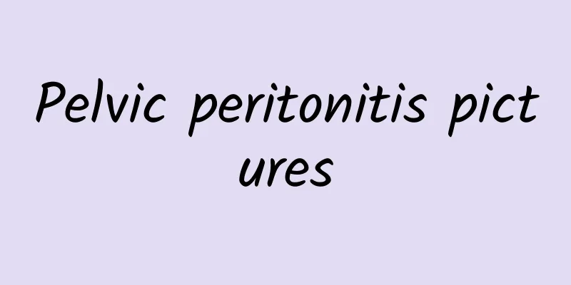 Pelvic peritonitis pictures