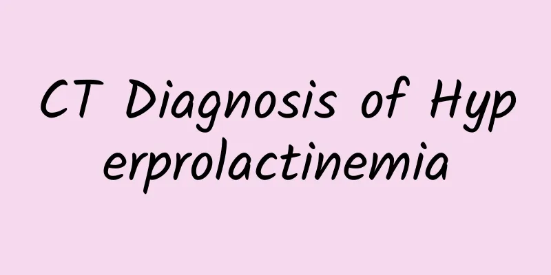 CT Diagnosis of Hyperprolactinemia