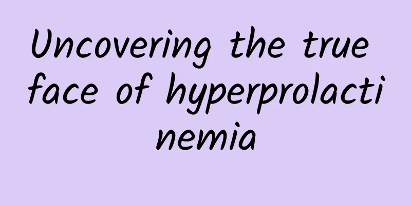 Uncovering the true face of hyperprolactinemia