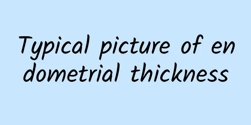 Typical picture of endometrial thickness