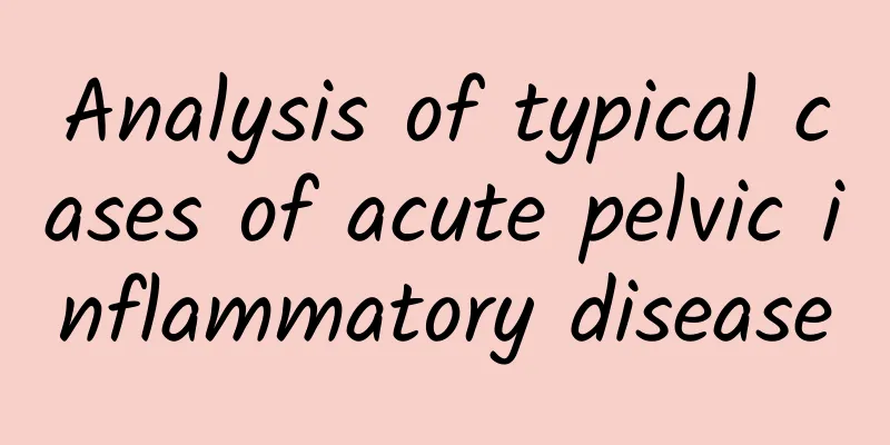 Analysis of typical cases of acute pelvic inflammatory disease