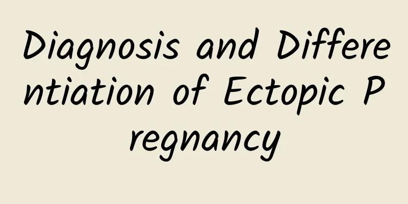 Diagnosis and Differentiation of Ectopic Pregnancy