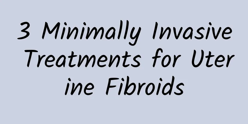 3 Minimally Invasive Treatments for Uterine Fibroids