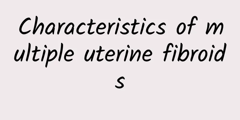 Characteristics of multiple uterine fibroids