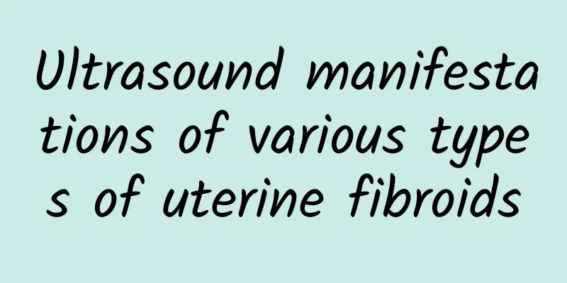 Ultrasound manifestations of various types of uterine fibroids