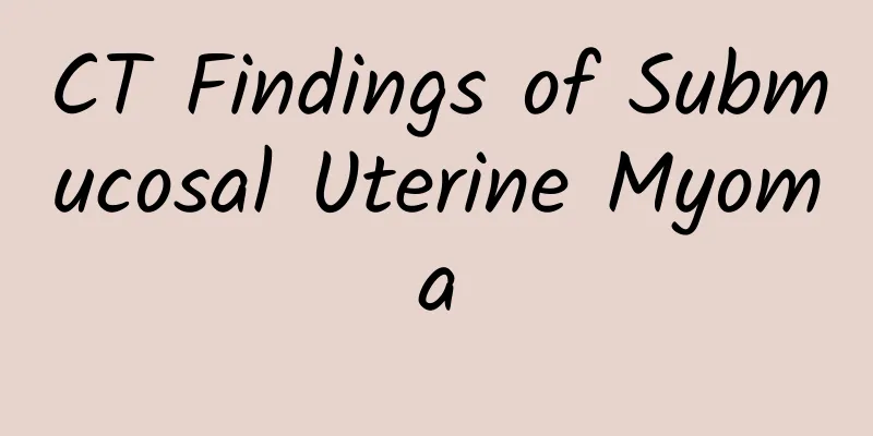 CT Findings of Submucosal Uterine Myoma