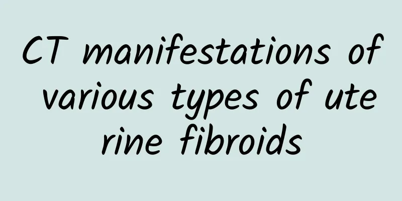 CT manifestations of various types of uterine fibroids