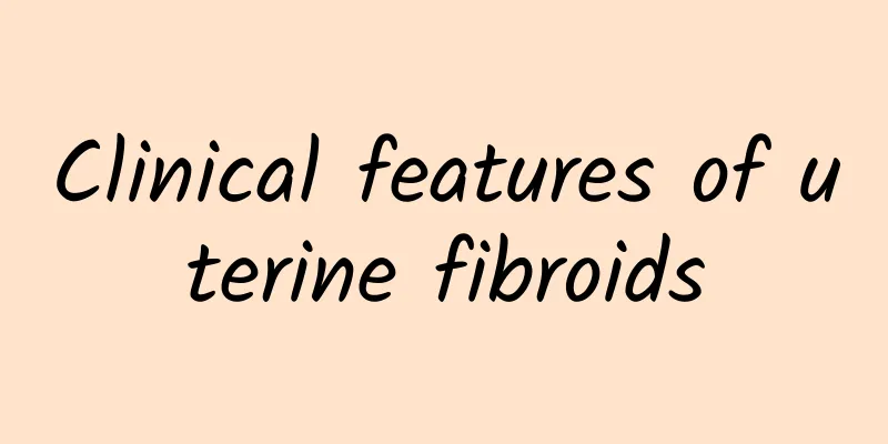 Clinical features of uterine fibroids