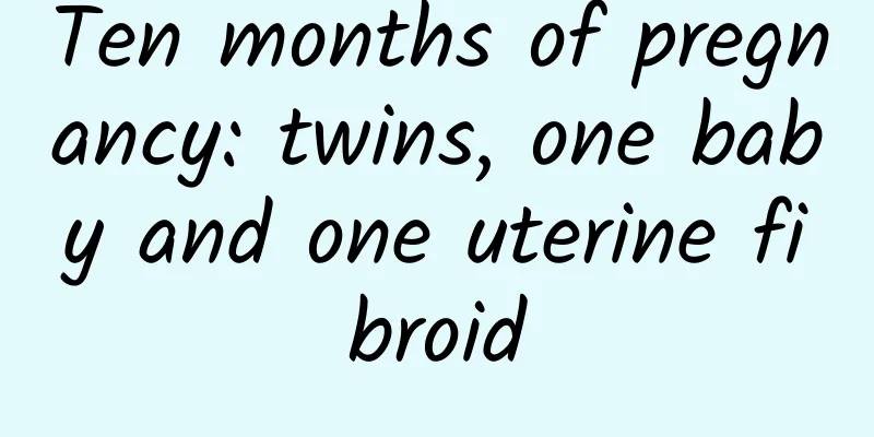 Ten months of pregnancy: twins, one baby and one uterine fibroid