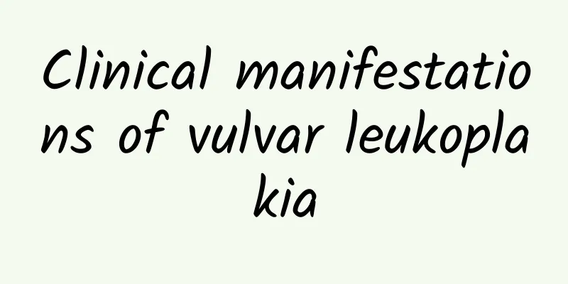 Clinical manifestations of vulvar leukoplakia